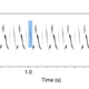A swamp sparrow song, in frequency (pitch) over time. The pink represents a syllable that comprises a descending tone, then a rising tone, a higher pitched down, and another descending tone. The blue represents a single element of a syllable.